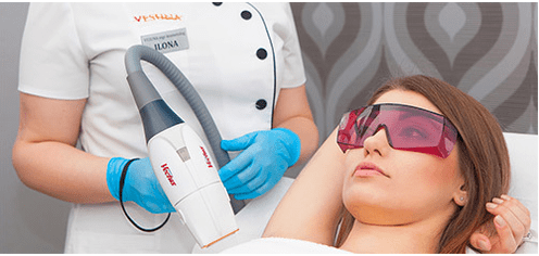 Rajeunissement au laser