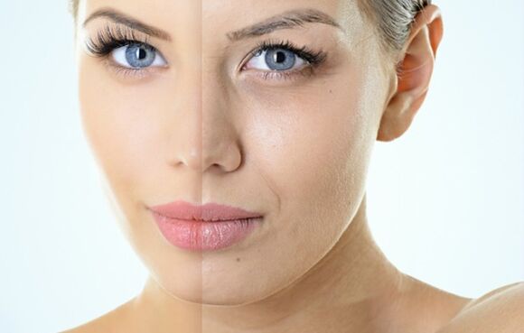 Indications pour le rajeunissement fractionnaire